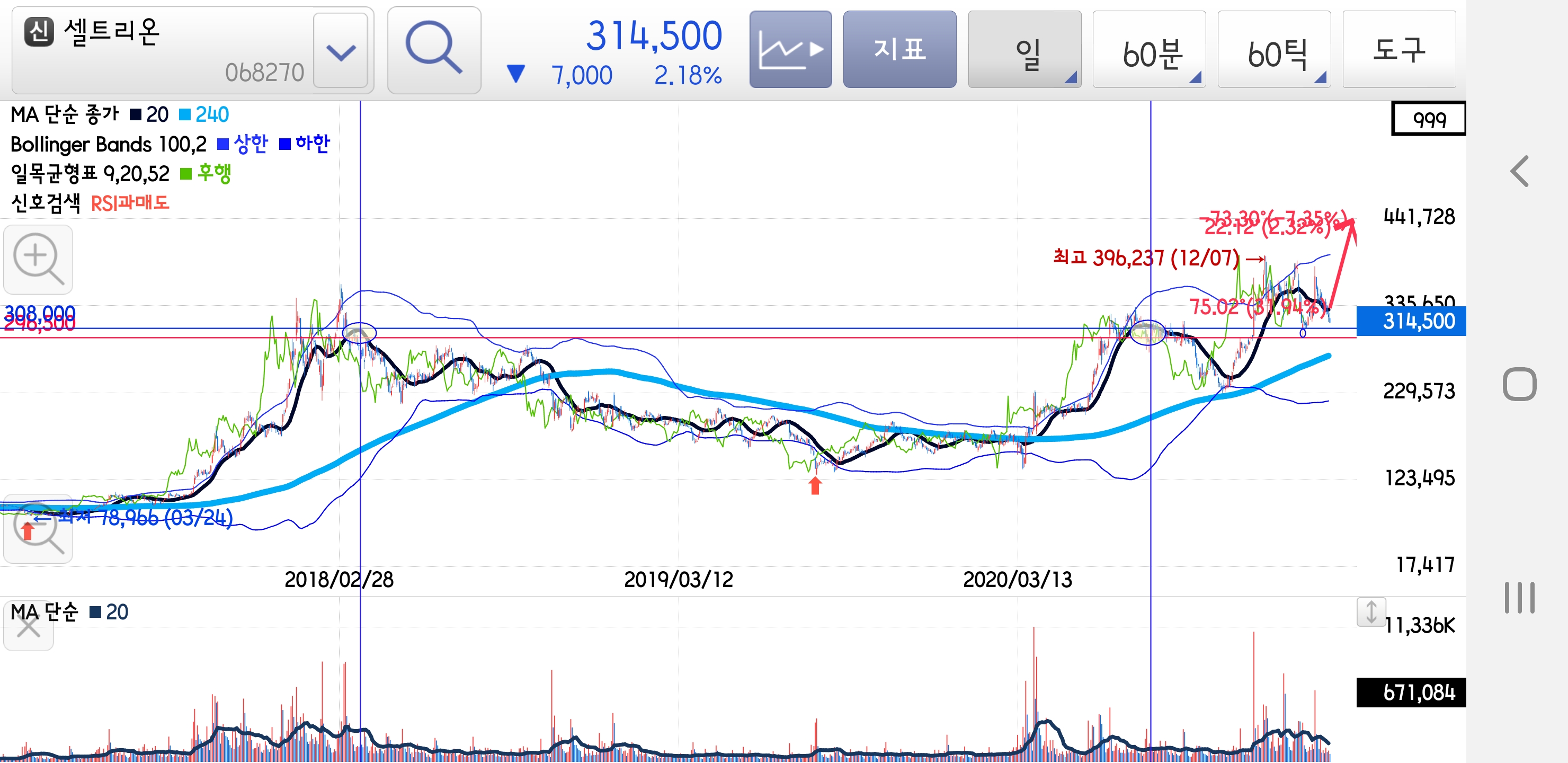 씽크풀 : 일봉차트를 보아도 셀트는 상승확률 1000%입니다.